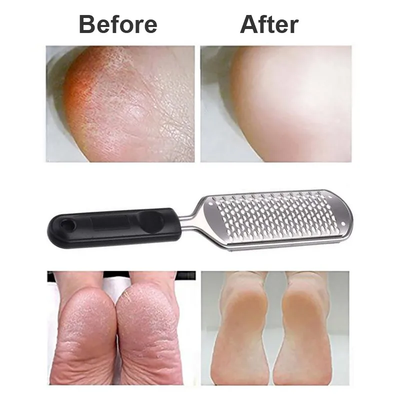 

Stainless Foot Scrubber Foot File Steel Foot Grater Foot Care Pedicure Tools Foot Rasp Callus Remover