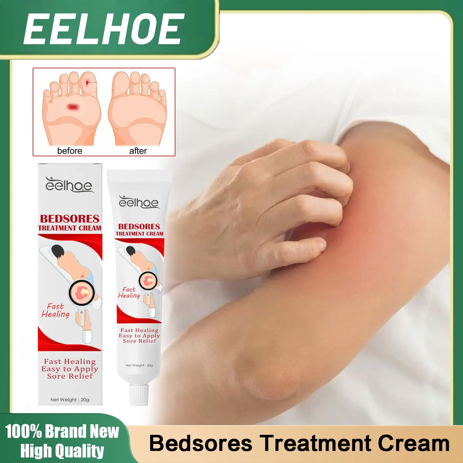 

Bedsores Treatment Cream Rot Myogenic Removal Pressure Sores Ulcer Skin Relief Ointment Wound Healing Health Care Plaster 20g