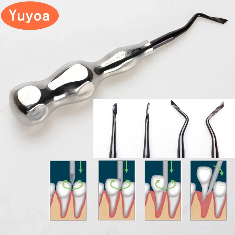 Стоматологическая спиральная отвертка