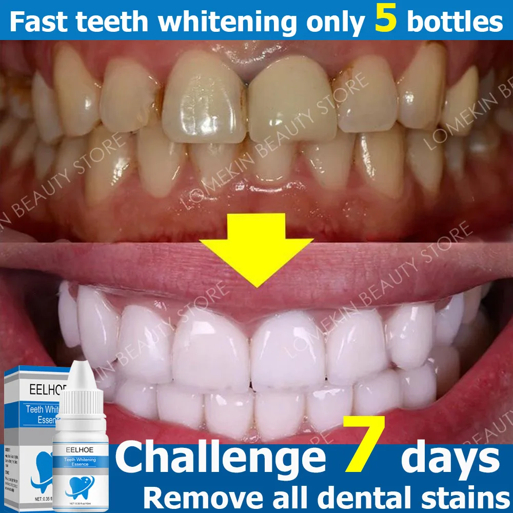 Effective Teeth Whitening Essence Tooth Plaque Yellow Stain Remover Tartar Cleaning Dental Bleach Serum Oral Hygiene Products
