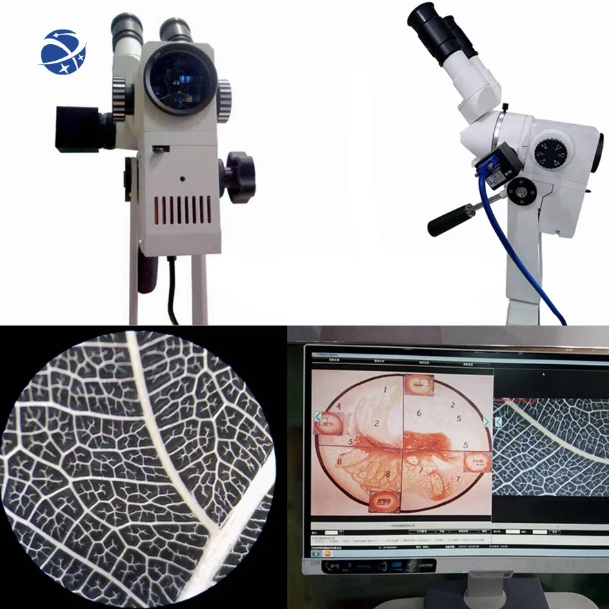 Kernel KN 2200BII медицинская гинекология вагинальная диагностика HD оптический