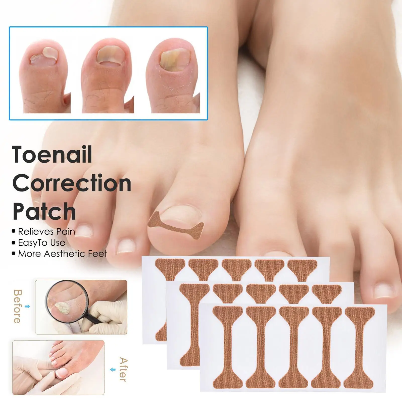 

10/5/4pcs Nail Correction Stickers Nail Ingrown Toenail Treatment Paronychia Tools Pedicure Patches Recover Corrector Corre K2W2