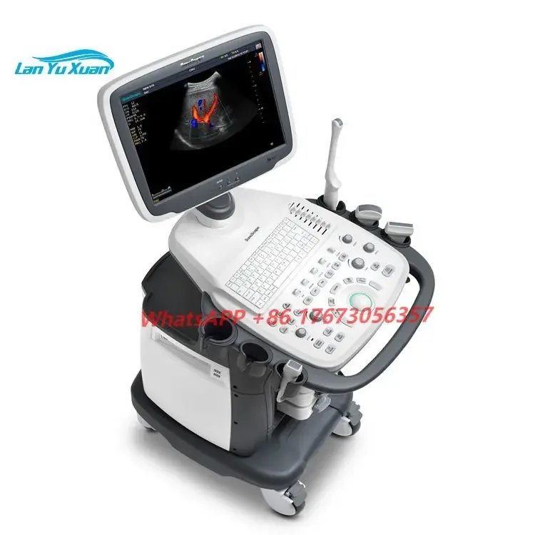 Мобильный ультразвуковой аппарат