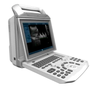 my a005a portable all digital ultrasound system laptop machine 12 1 inch high definition lcd medical ultrasound instruments