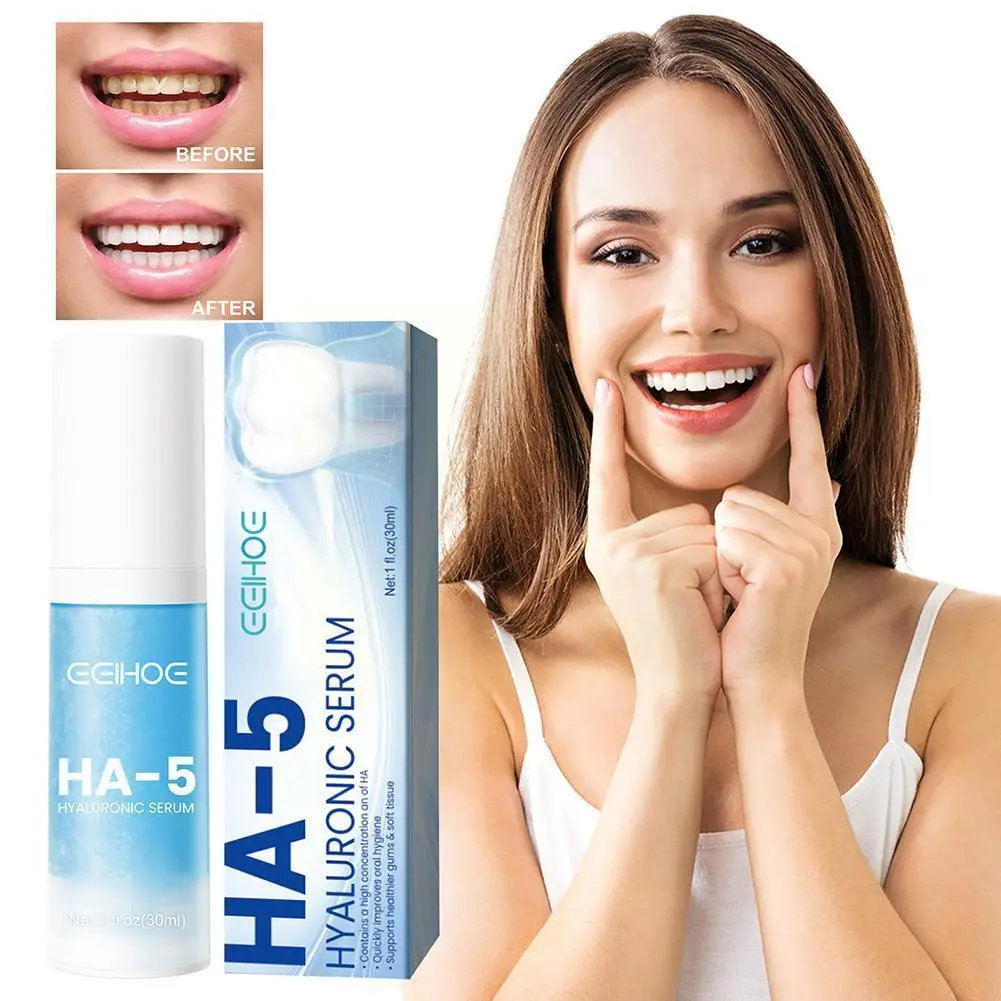 

30ml Toothpaste Mousse Cleaning Whitening Remove Yellow Remove Oral Prevent Tooth Cleaning Teeth Tooth And Stains Decay Hyg R8P4