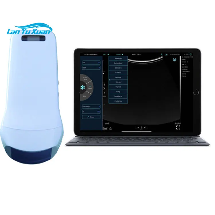 

Wireless Portable Triple Heads Color Doppler Ultrasound Linear / Convex / Phased Array Probe for Physical Examination