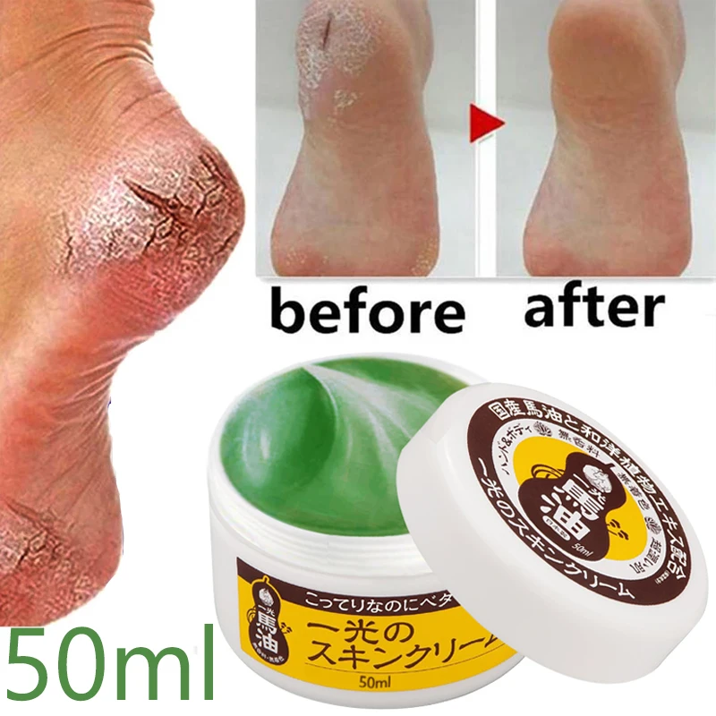 

Natural Horse Oil 50ml Oily Anti-Cracking Foot Cream Cracked Heel Repair Cream Remove Dead Skin Hand & Foot Care Home