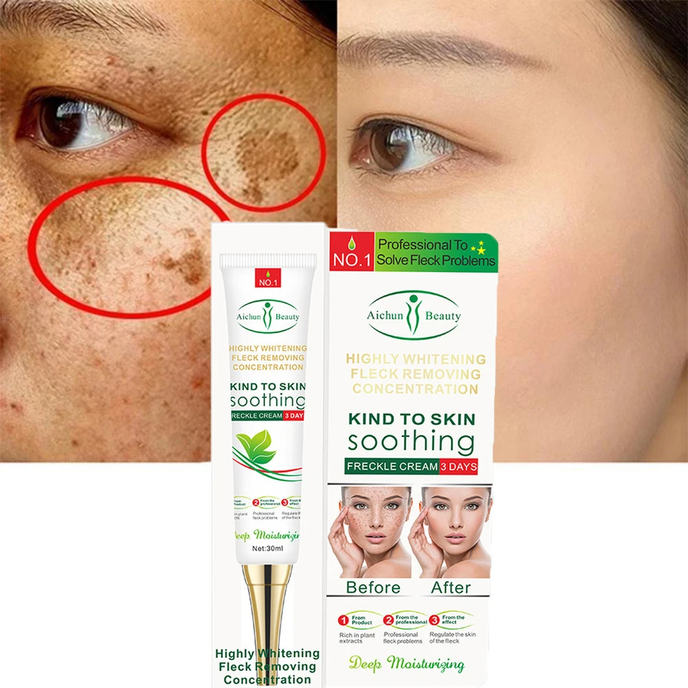 

Whitening Freckle Cream Remove Dark Spots Effective Fade Acne Scar Lightening Melanin Brightening Melasma Anti-Aging Facial Skin