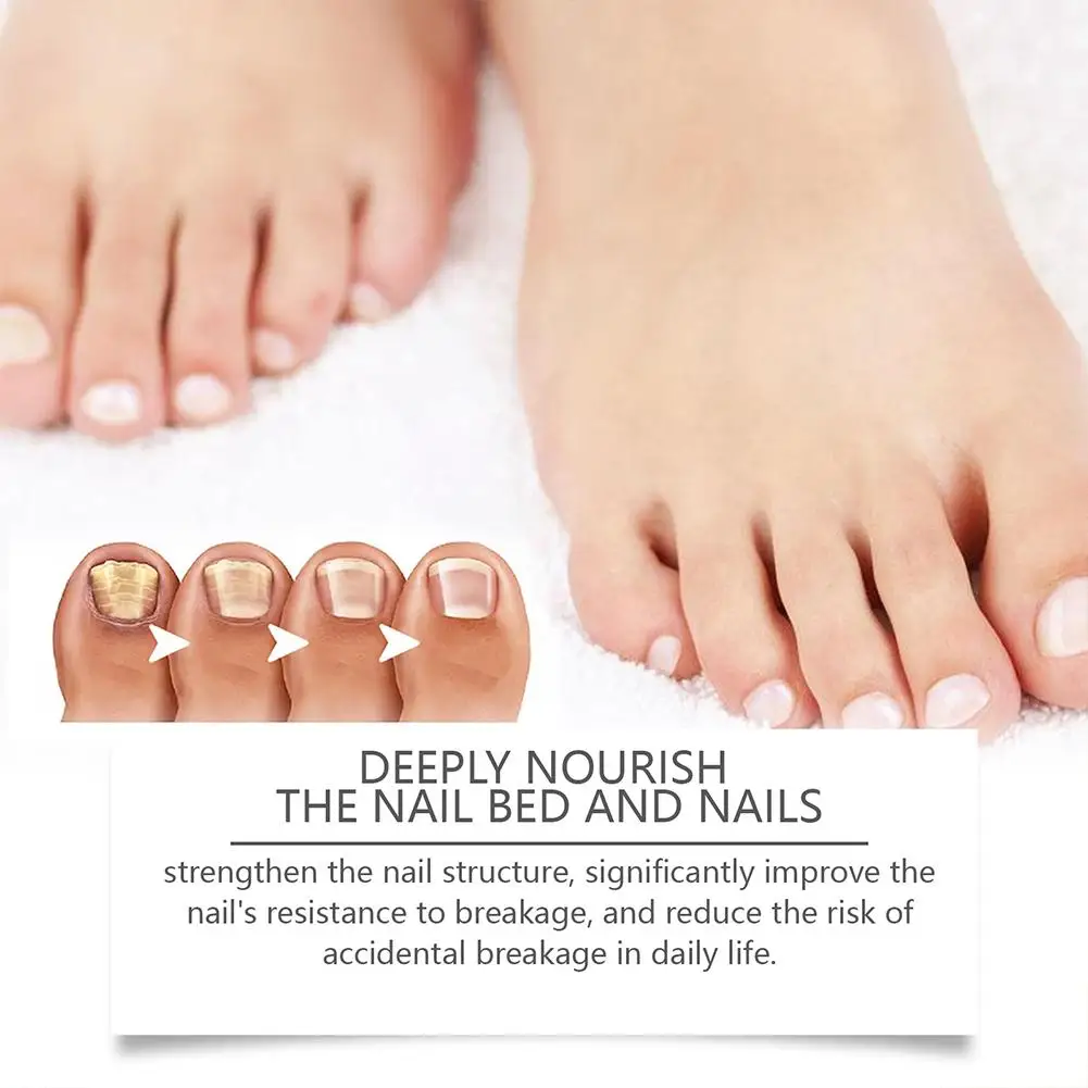 4 мл средство для ремонта ногтей применяемый ухода за ногтями руками и ногами