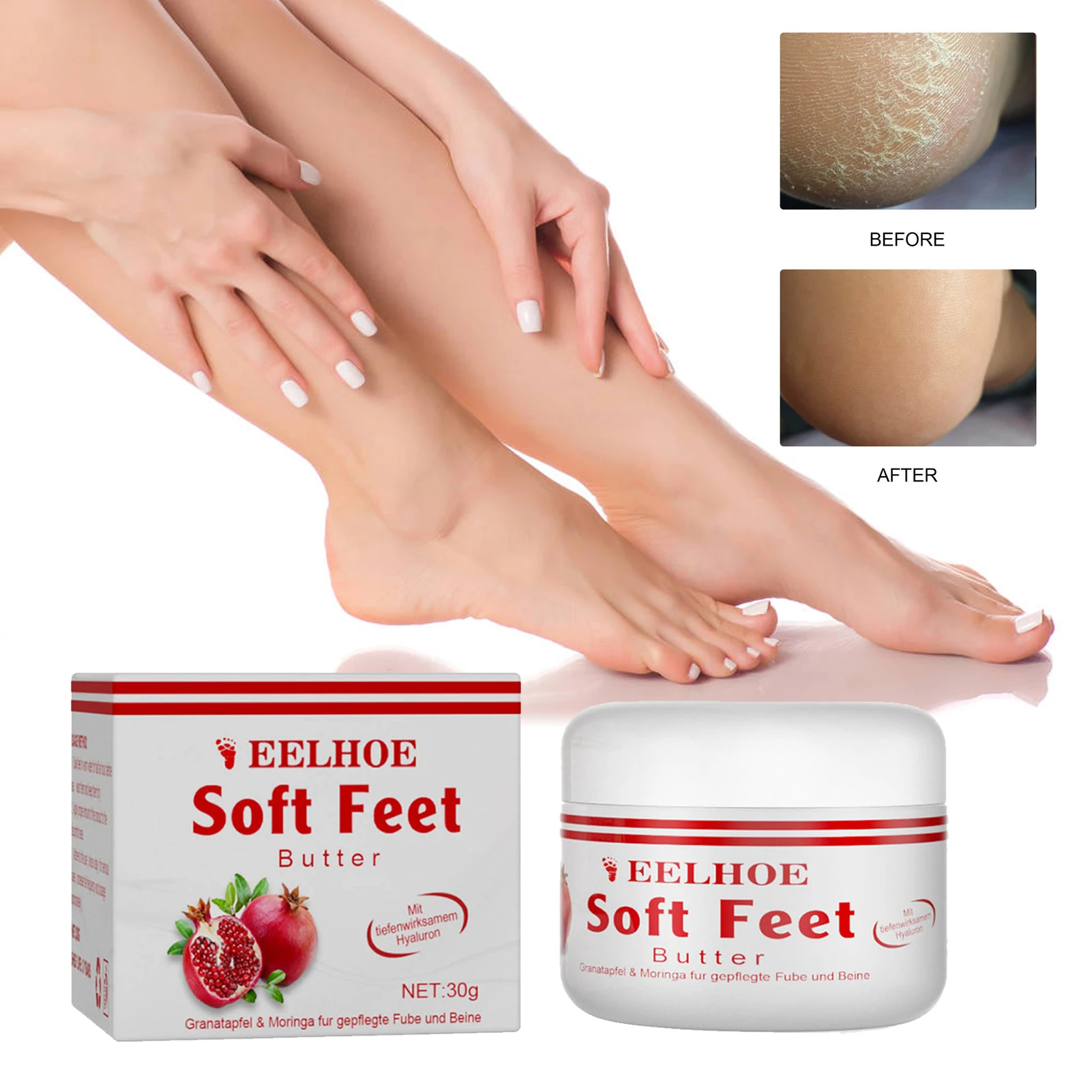 

Sdotter Foot Cream For Calloused Feet Foot Cream For Dry Cracked Heels And Callus Remover Soft Feet Butter Intensively Moisturiz