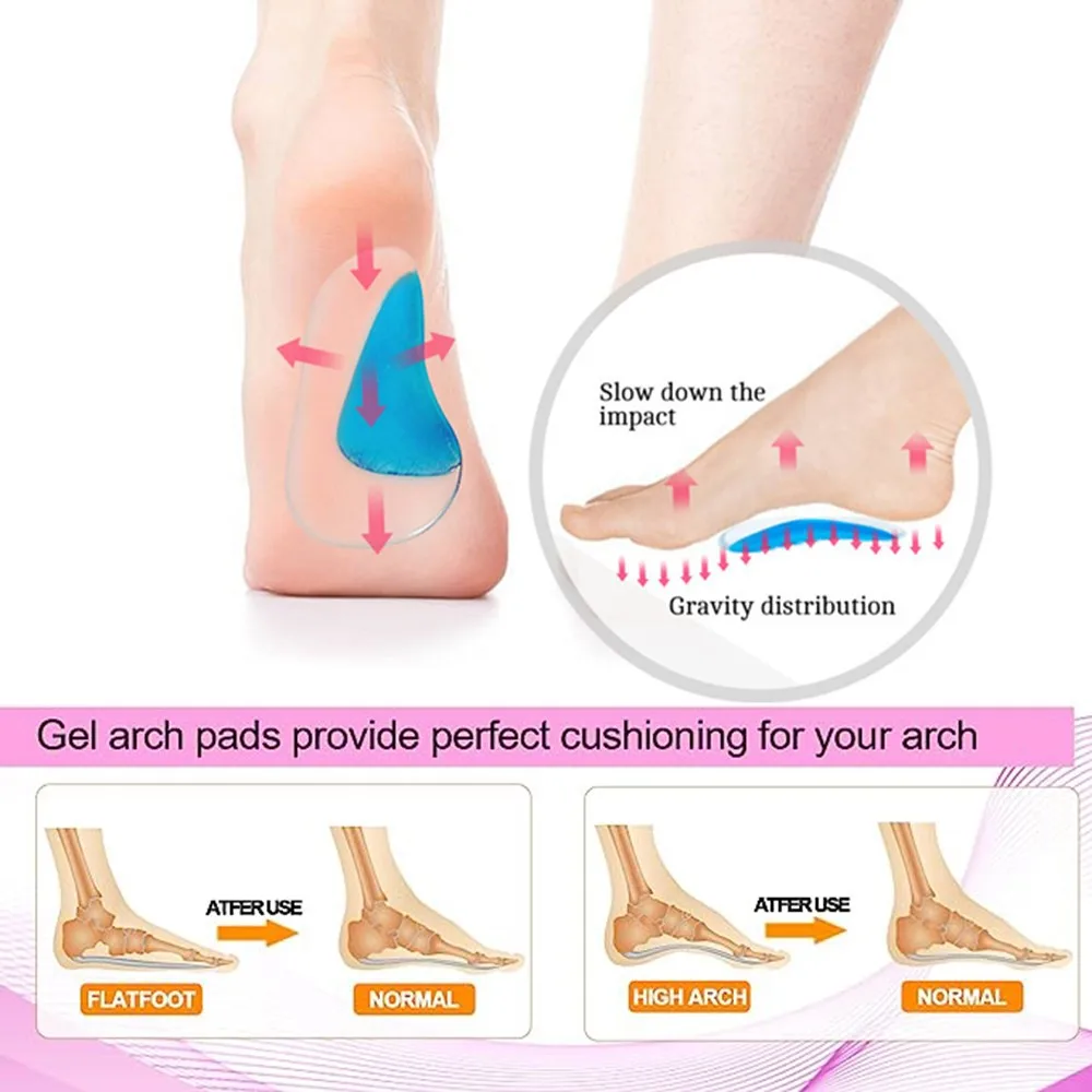 Silicone Orthopedic Insoles for Shoes Women Feet O/X  Plate Flat Foot Corrector Shoe Cushion Orthotic High Arch Support Insoles
