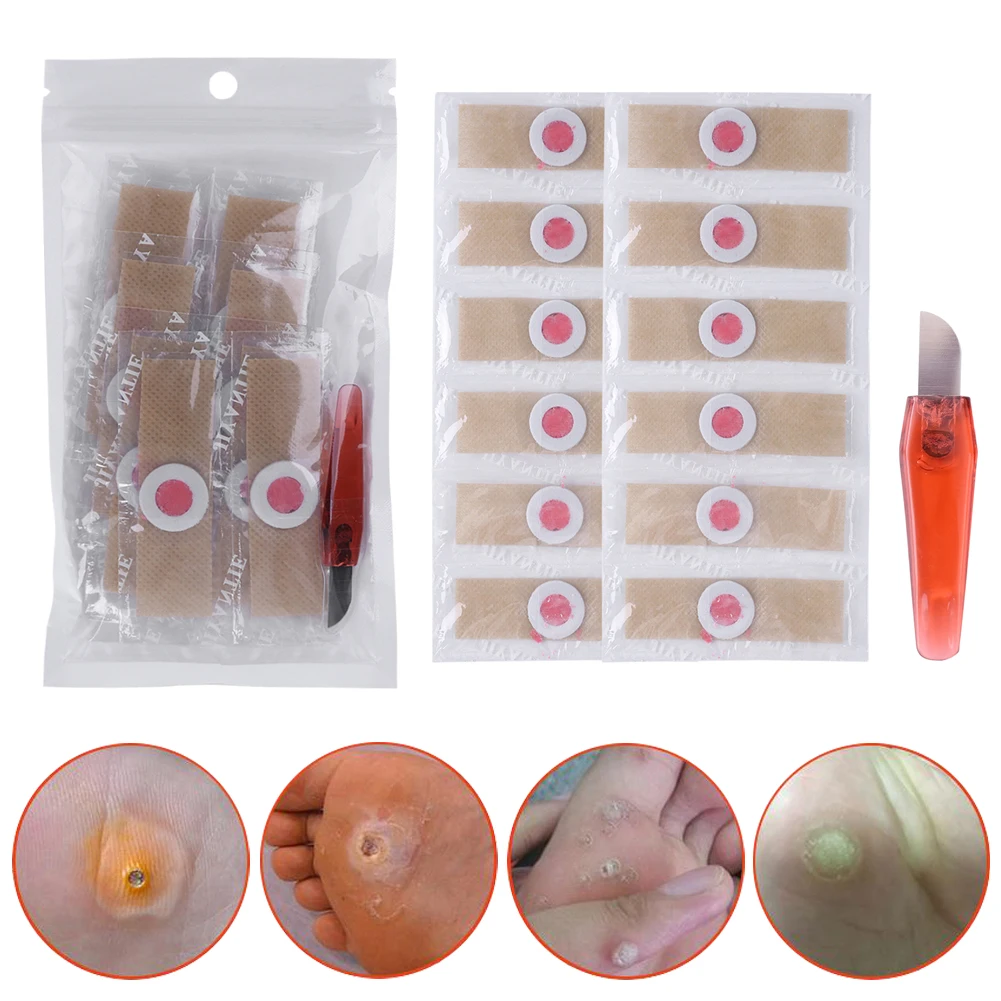 

Foot Toe Corn Detox Patches Calluses Thorn Sticker Plaster Corns Remover Kit Effectively Fight Deep Pathogens Little Pain