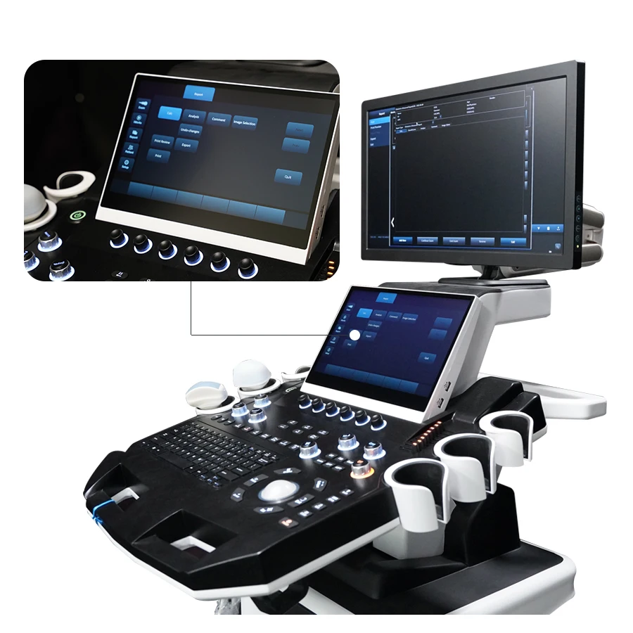 Рисунок 3 - Портативный цветной Доплеровский