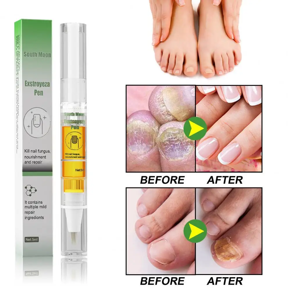 

5ml Functional Universal Compact Pedicure Nail Repair Liquid for Home Nail Treatment Essence Nail Repair Liquid