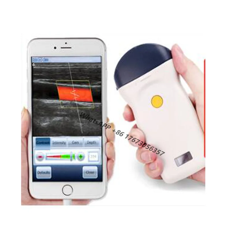 

Non-destructive Testing Wireless B-ultrasound Veterinary Black And White Color Diagnostic Ultrasonic Scanner