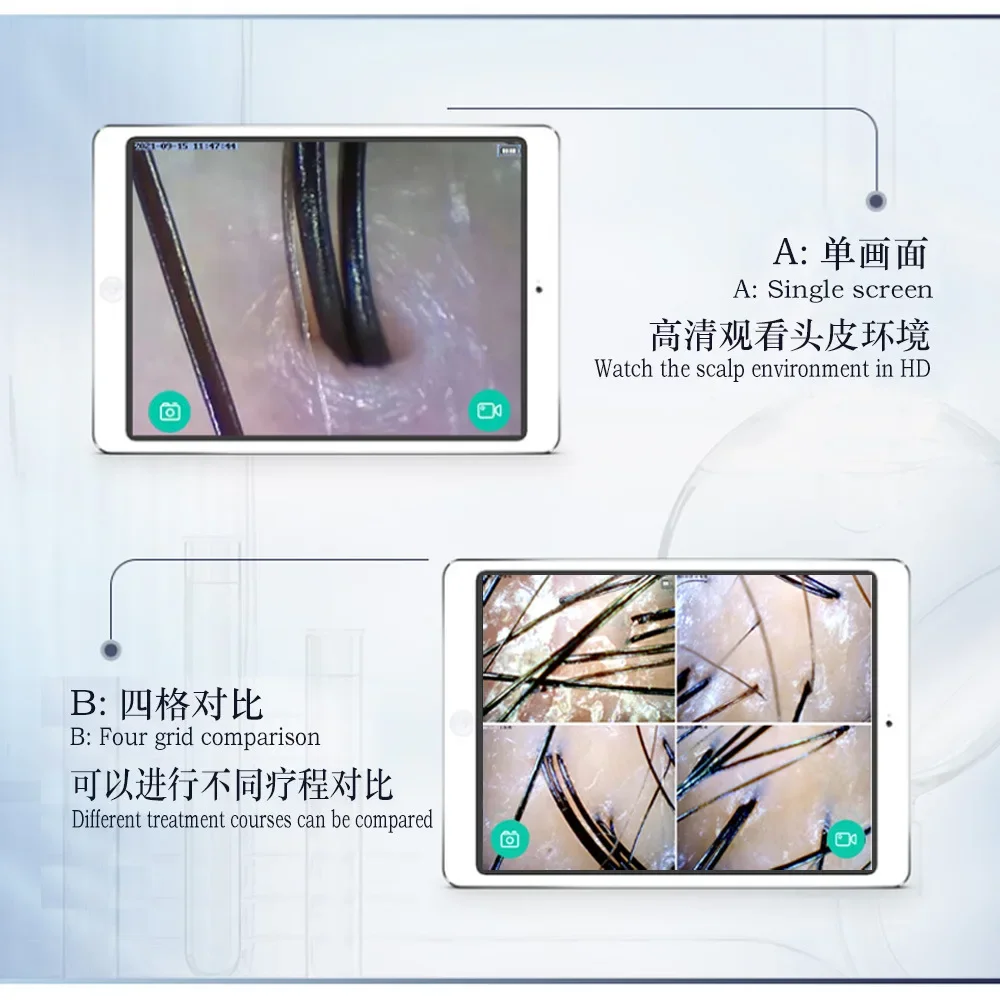 Машина для защиты волос уход за кожей головы портативный 200-кратный анализатор