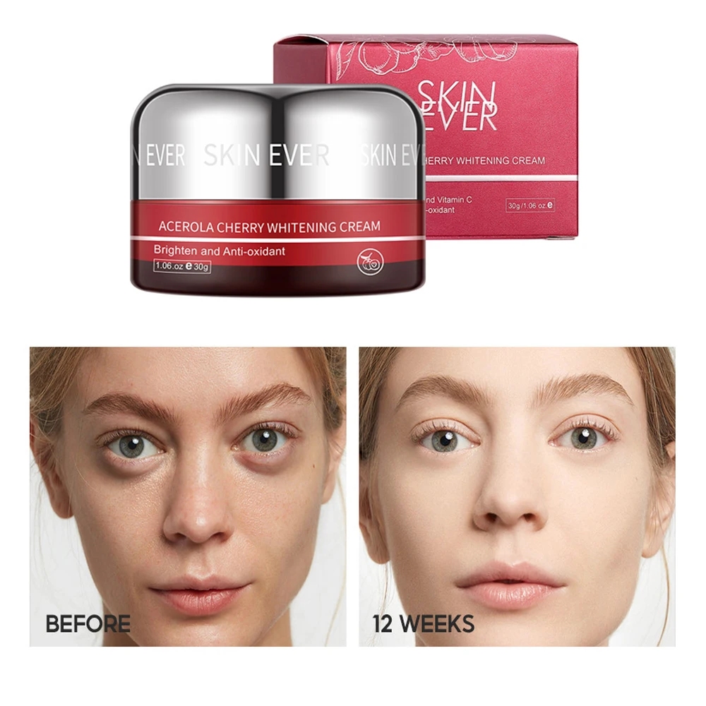 

Whitening Freckle Cream Dark Spots Removal Improve Dull Skin Stains Lighten Spots Face Cream Moisturizing Whiten Skin Care 30ml