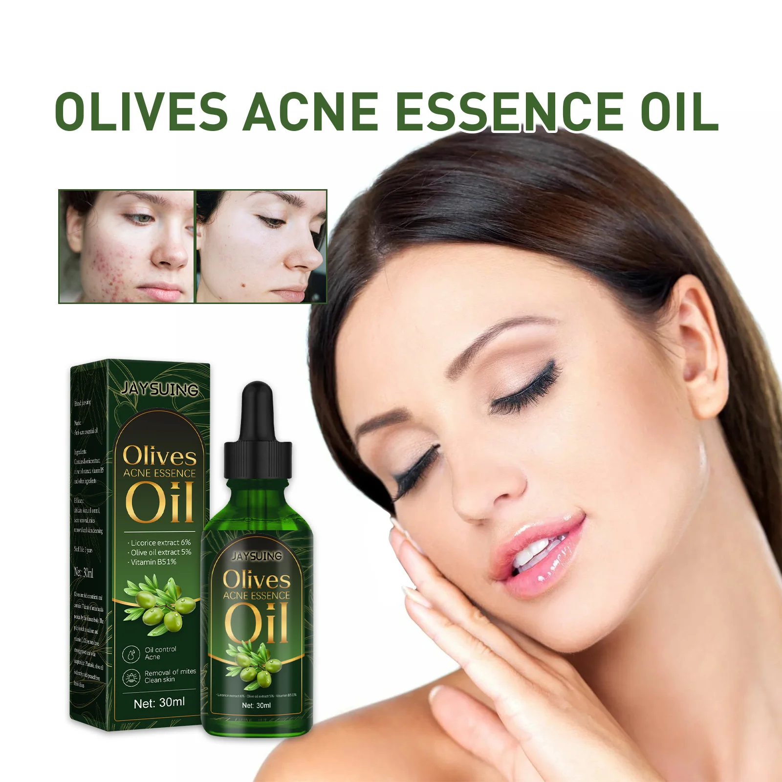 

Оливковое масло для ухода за лицом, эфирное масло для лечения акне, средство для удаления черных точек, против шрамов, пятен, увлажняющий мас...
