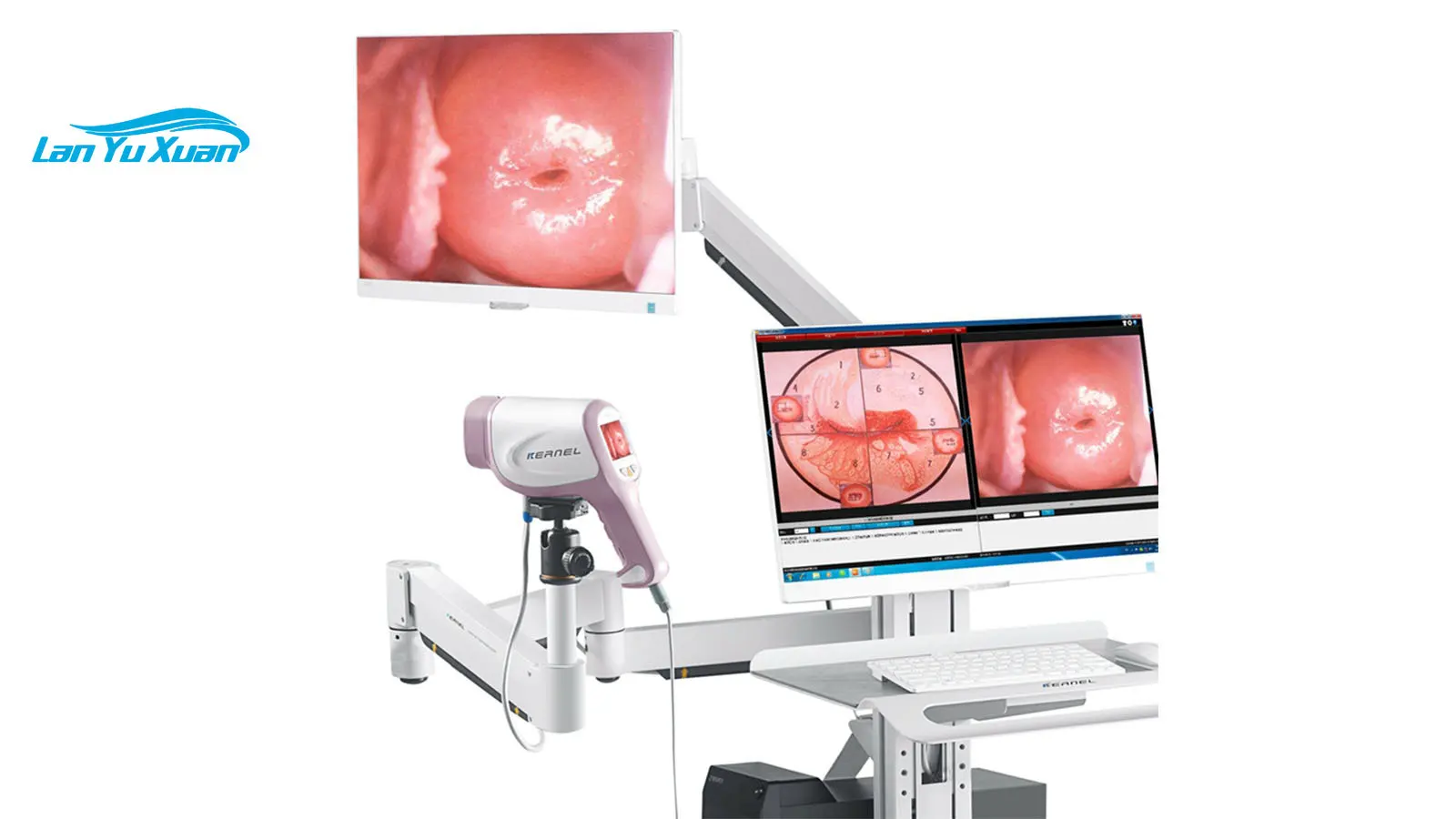 

CE cleared colposcopy Kernel KN-2200I(H) cervical cancer screen full hd digital colposcope camera gynecology colposcope