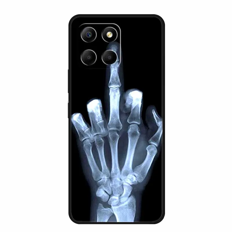Фото Чехол для Honor X8b HonorX8b X 8 b Coque Противоударный черный силиконовый мягкий чехол для телефона Honor X6b Play 9A X5b Plus №2