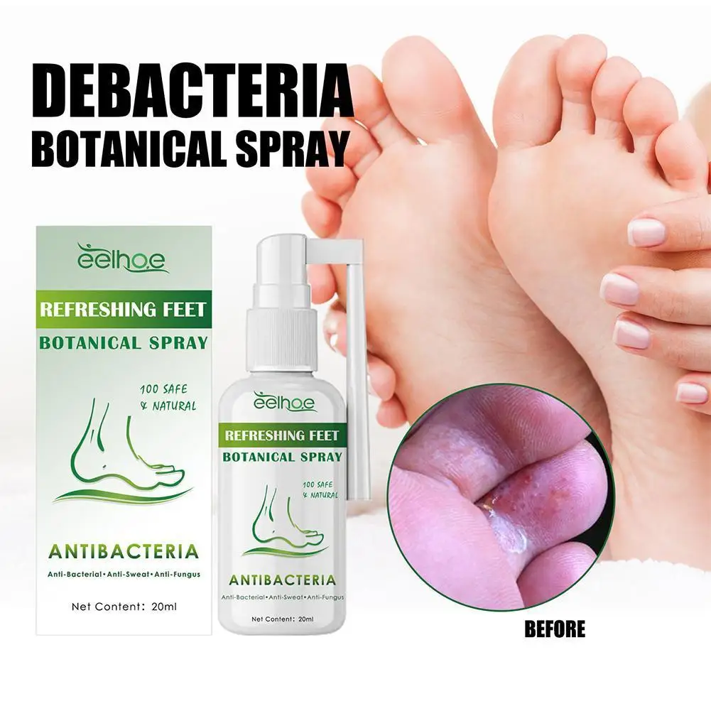 

Anti Fungal Spray Foot Fungal Cream Relieve Beriberi Toe Treatment Gel for Cracked Heel Peeling Blister Repairing Feet Oint Q6L9