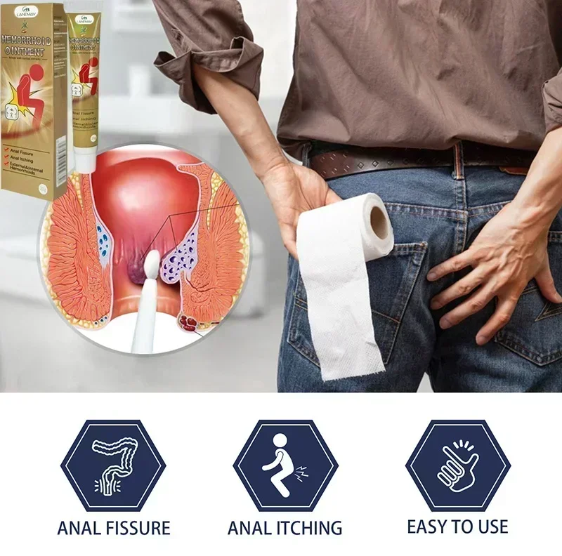 Средство для удаления геморроя NewHemorrhoid облегчение анального ануса отека лечение