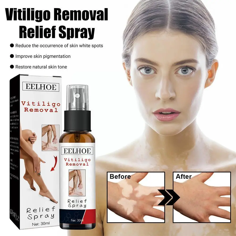 

Спрей для восстановления и увлажнения кожи Vitiligo, увлажняющая сетка для лица и пятен, белый рельефный спрей для кожи Vitiligo E8F8, 30 мл