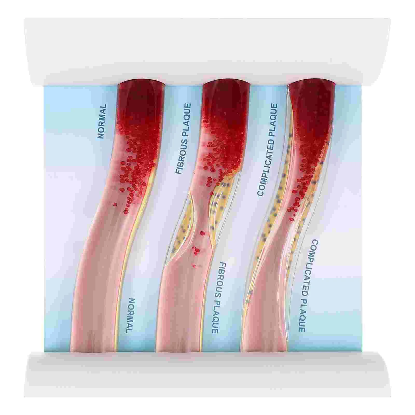 

Human Body Anatomical Model Low-Density Lipoprotein Blood Vessel Model
