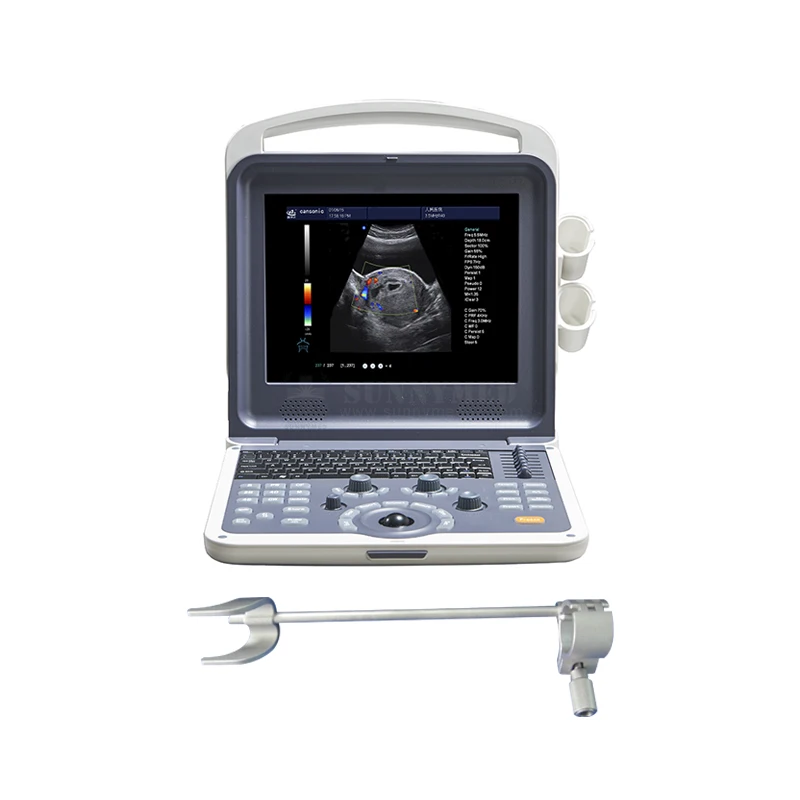 

SY-A042N Medical 4D Cardiac Color Doppler ultrasound with CW function