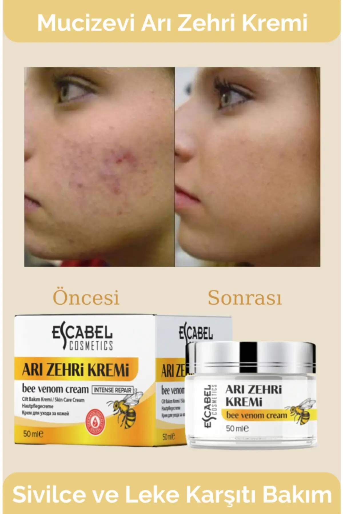 Orjinal Wonderful-crema Facial, limpiador de espinillas y acn&eacute;, veneno de abeja, antiimperfecciones, 50 ml-0