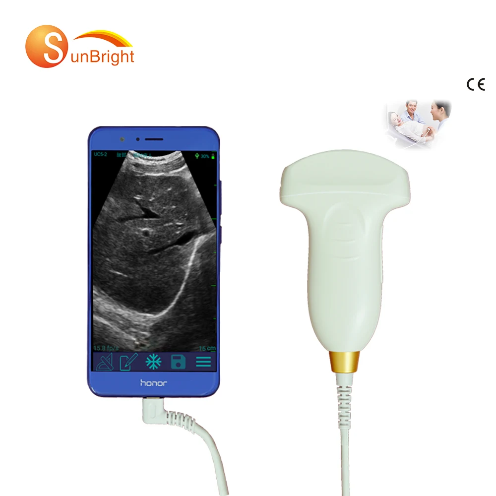 Портативное ультразвуковое устройство USB с выпуклым зондом ультразвуковой