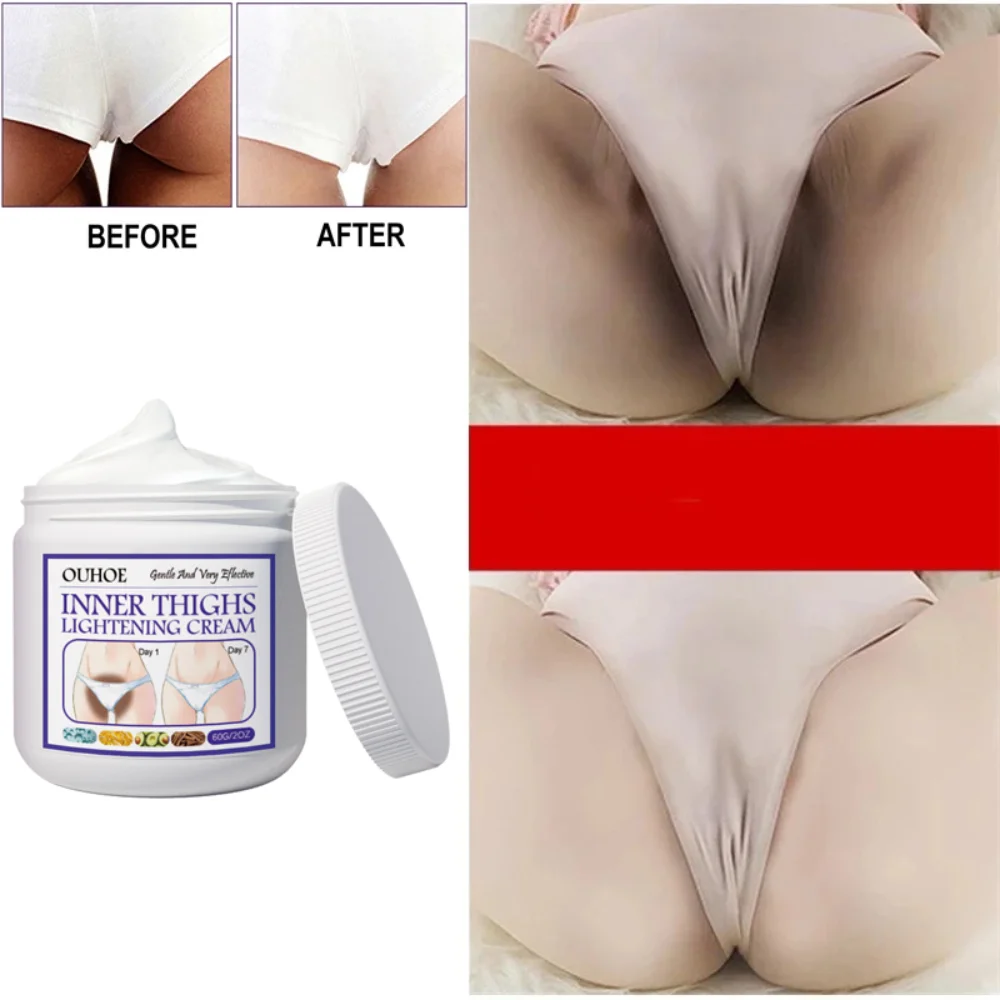 

Отбеливающий крем, частные части, отбеливающая Сыворотка для подмышек, отбеливание ягодиц, колена, осветление внутренней части бедра, интим...