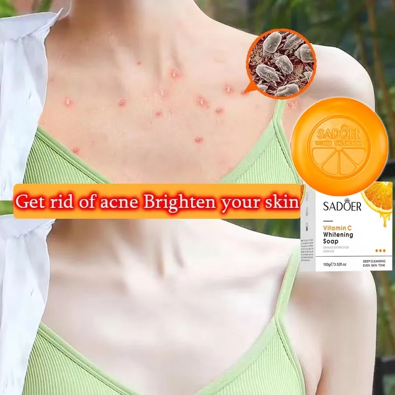 

Мыло для мытья тела VC, 100 г, отбеливание, удаление акне, черных точек, прыщей, эффективный продукт для ухода за кожей, мыло ручной работы для мужчин, женщин и мужчин