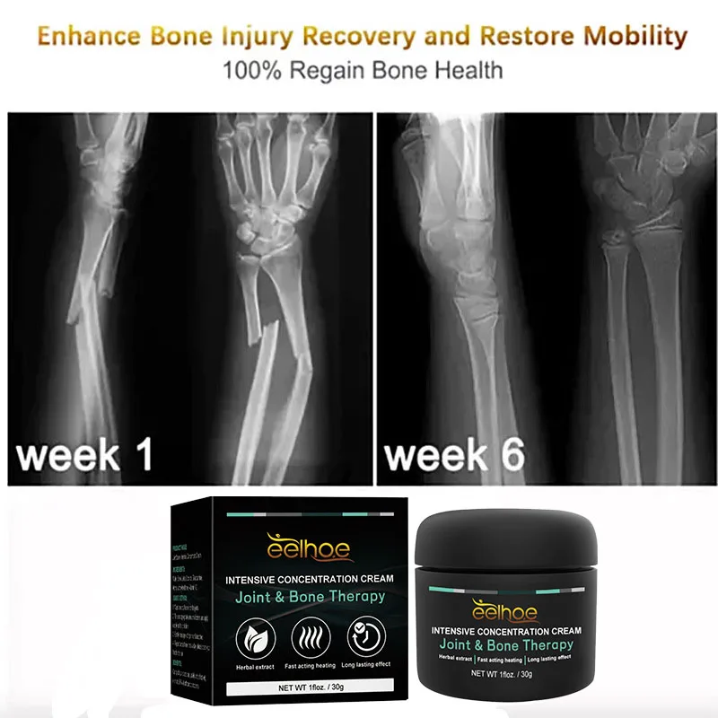 Коррекция облегчение боли в суставах средство для защиты суставов эффективного