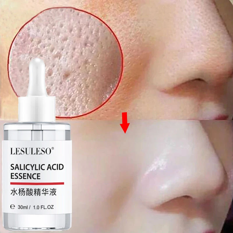 

Salicylic Acid Pore Shrink Face Serum Smooth Pores Hyaluronic Acid Moisturizing Nourish Repair Essence Firm Cosmetics 2023