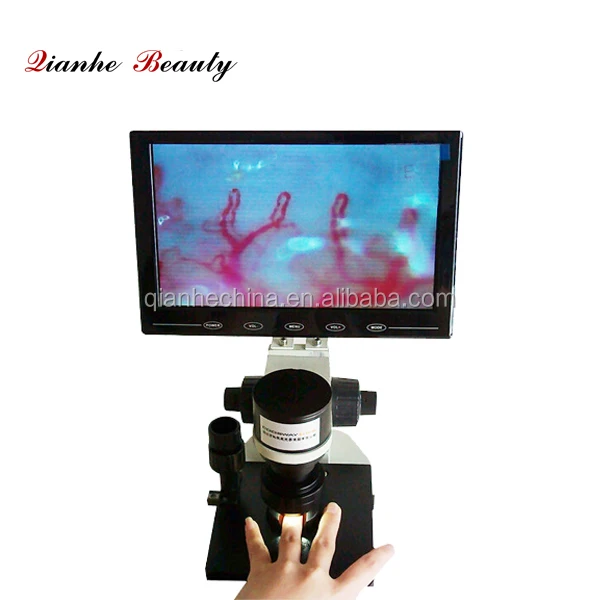 

QH-N01 Профессиональный капиллярный микроскоп микроциркуляция