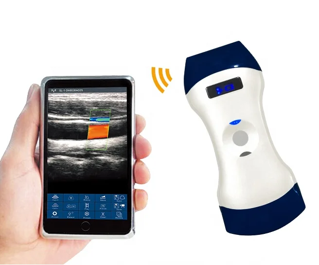 

portable color doppler wireless ultrasound probe 3 in 1