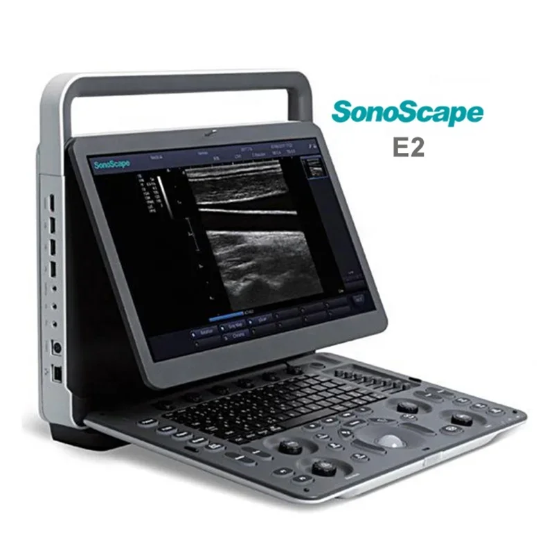Рисунок 3 - Sonoscape E2V, большая портативная