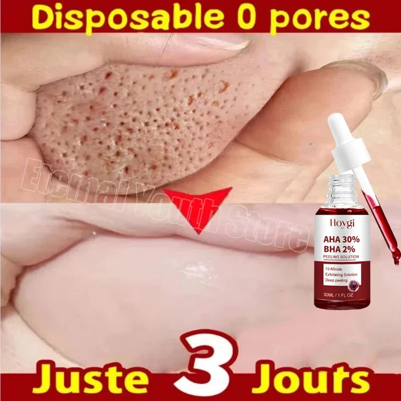 Сыворотка для сужения пор пилинг лица удаление больших подтяжка восстановление