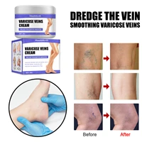 effective varicose veins relief cream relieve vasculitis phlebitis spider pain treatment ointment medical plaster body care