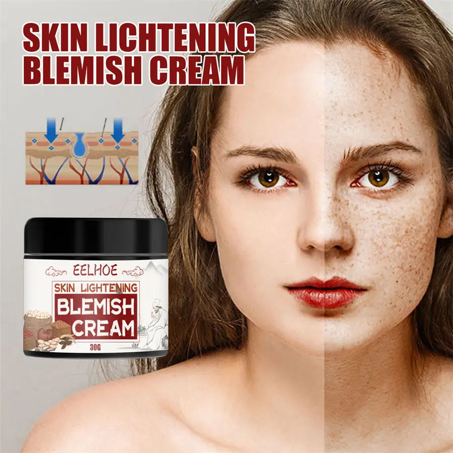 

Lightens Spots Moisturizing Freckle Cream Ginseng Extract Whitening Remove Freckles Herbal Plant Face Cream And Dark Spots Skin