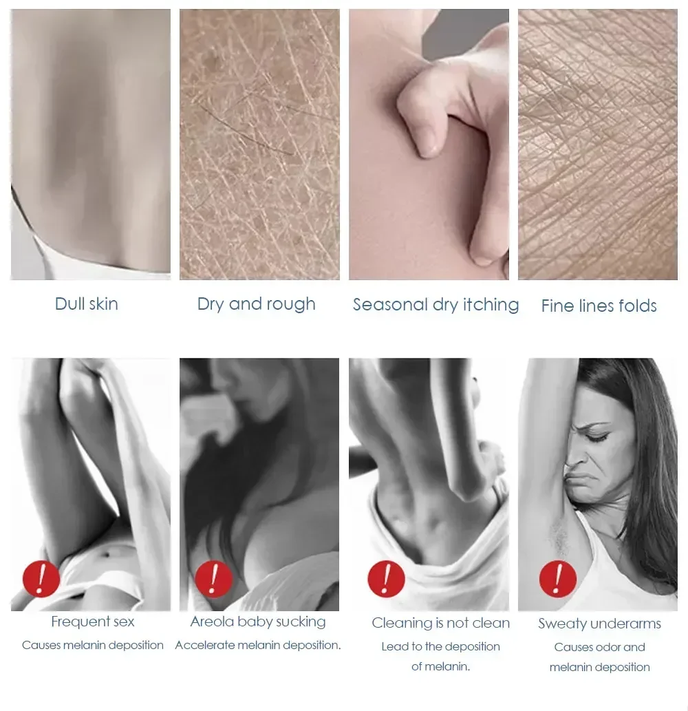 Крем для лица и тела осветляющий лосьон подмышек бедра меланина легкий