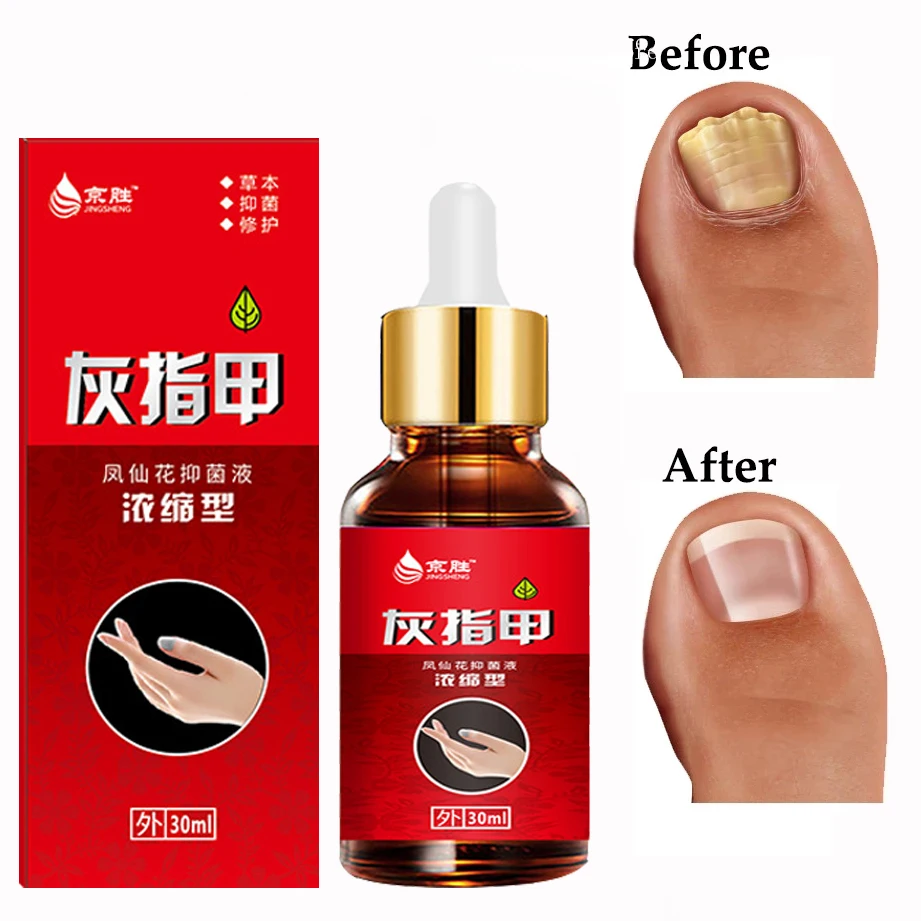 

Herbal Nourishing Nail Care Liquid Whitening Nails Remove Infection Improve Rough Nails Restore Nail Shine Nail Polish 30ML