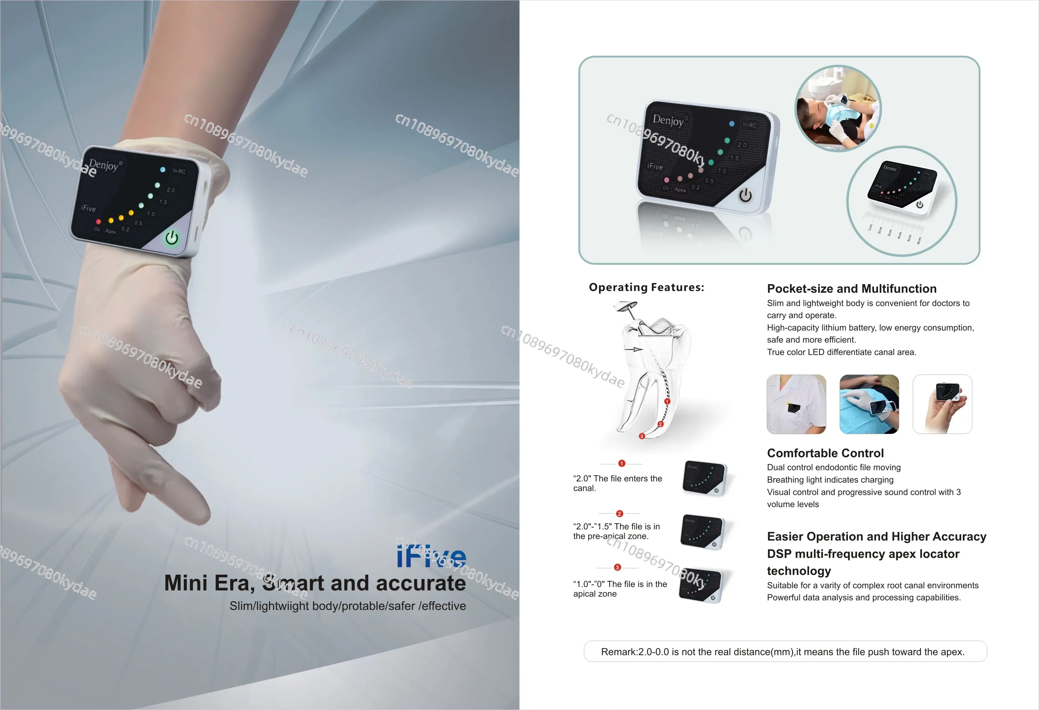 Стоматологическое эндодонтическое оборудование Локатор вершины Denjoy/Dental Apex Locator