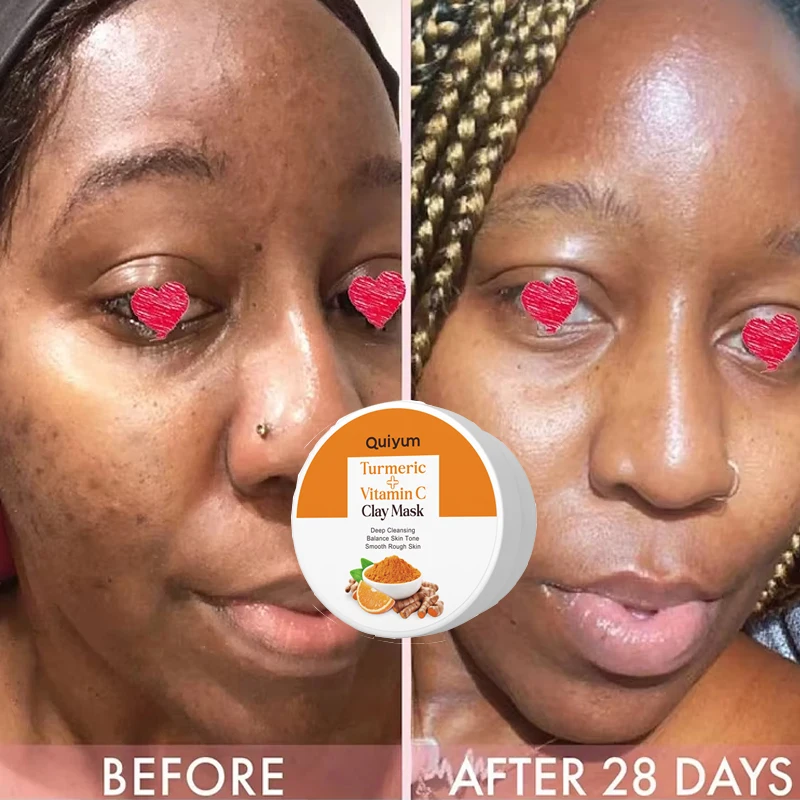 Грязевая маска с куркумой очищающая грязевая витамином С устраняет прыщи