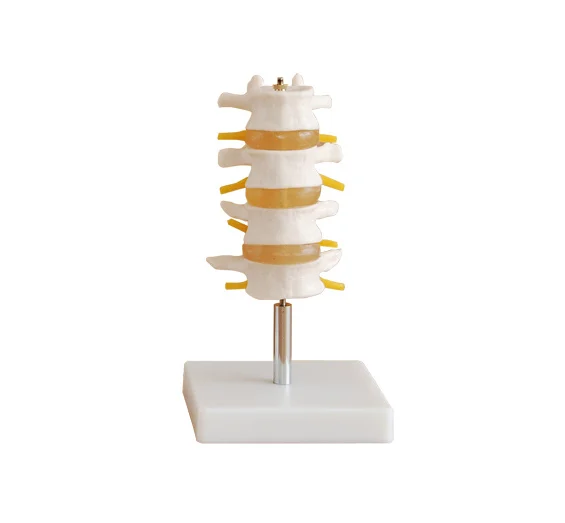 

Human Lumbar Vertebral Spine Anatomy Model,Life-size lumbar vertebrae Model
