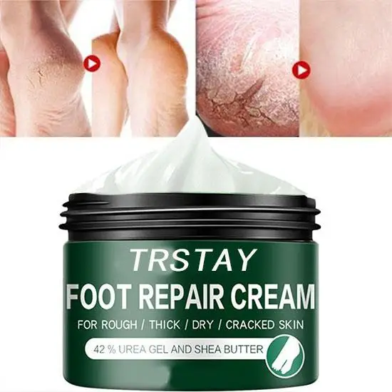

cream skin care products dead skin remover chapped Repair Cream skin whitening cream crema aclaradora de piel