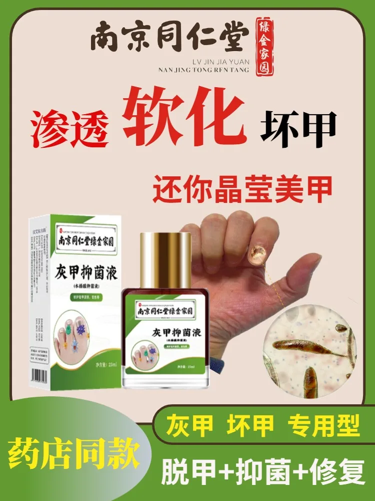 [Watsons Hot Sale] It Is Invalid to Remove 99% Gray Potassium Fungus without Removing Nail after Dropping a Drop!
