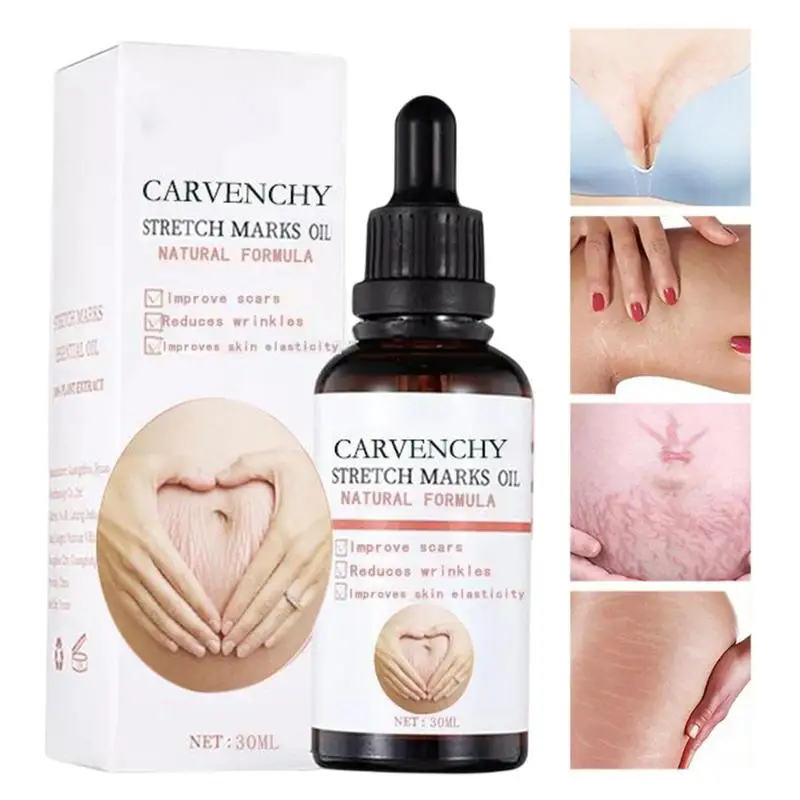 

30ml Stretch Mark Oil Natural Belly Essential Oil Massage Essential Oils Postpartum Skin Care