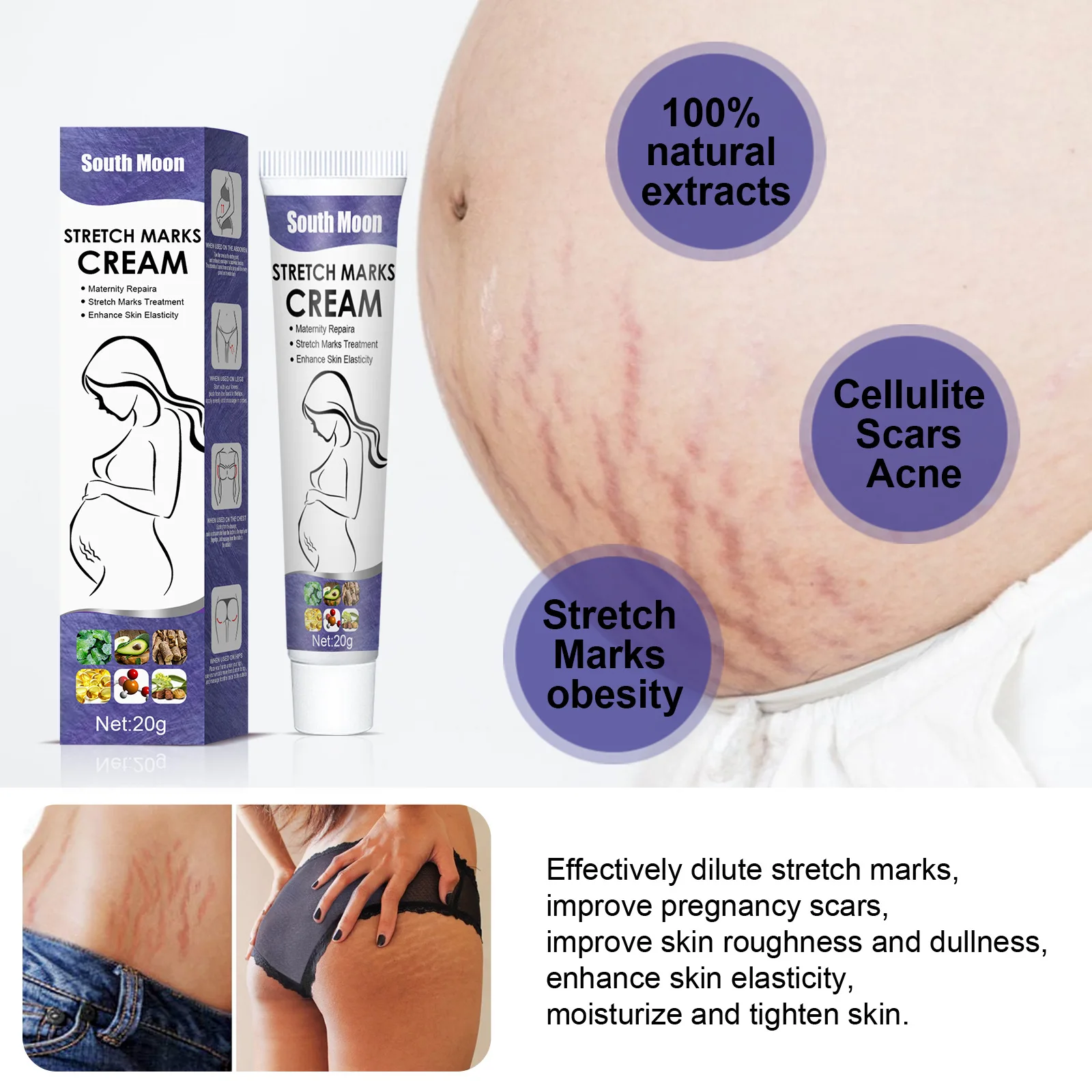 

Stretch Marks Permanent Removal Cream Maternity Pregnant Women Pregnancy Scar Repair Anti-Winkle Firming Body Care